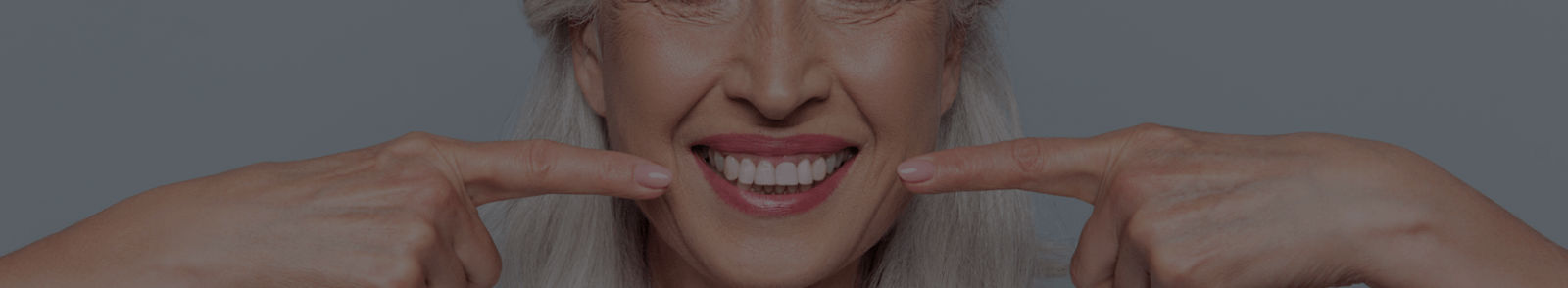 Blanchiment des dents (Bleaching)